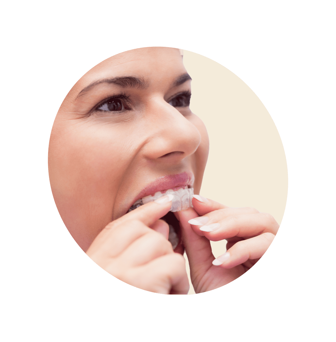 Invisalign in Bucktown, Chicago