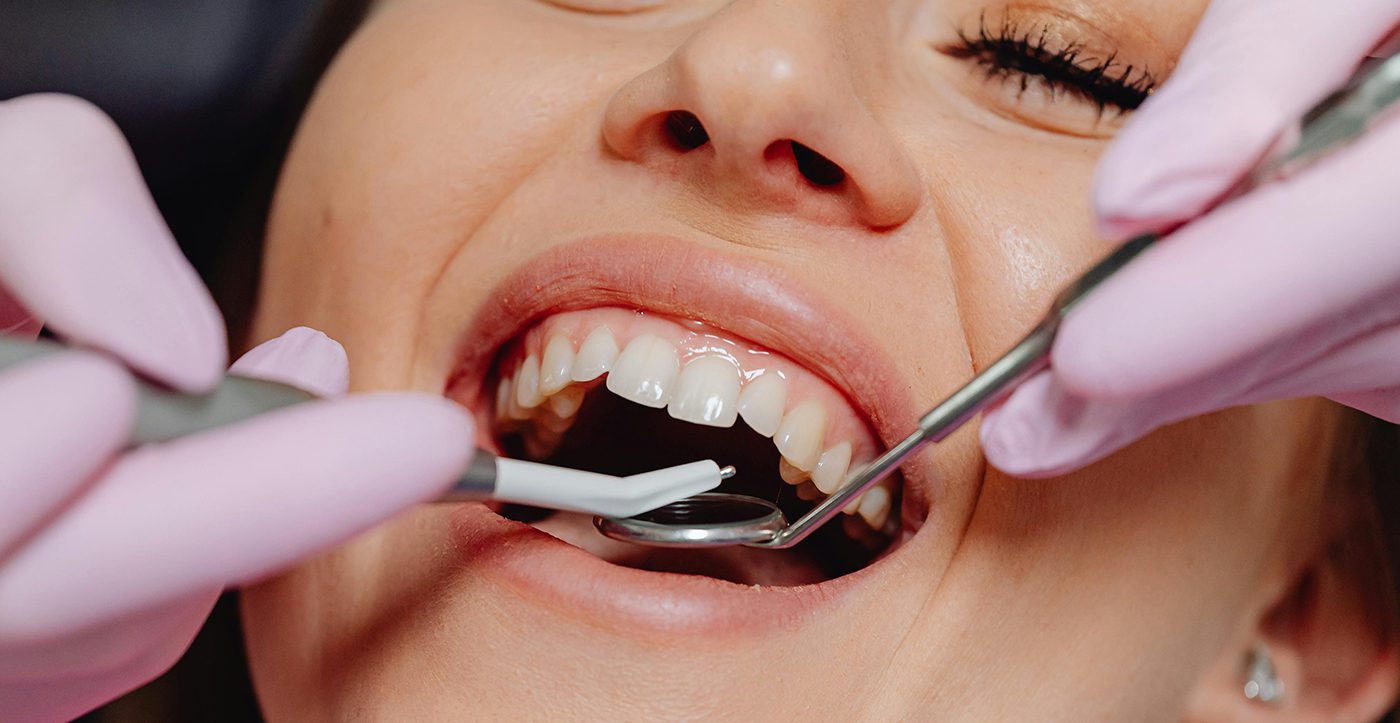 How to Stop Receding Gums From Getting Worse