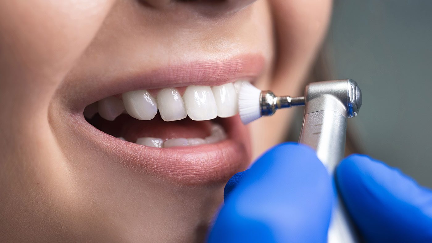 Why Dental Exams & Cleanings Matter