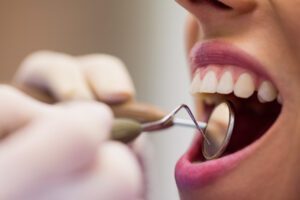 Bite Club dentist examining a female patient with tools