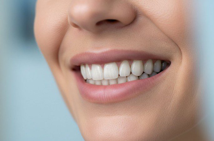 Is a Single Tooth Implant Worth It?
