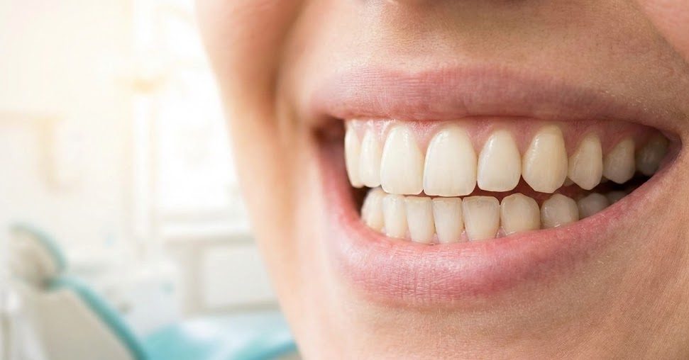 Teeth Whitening Is Overrated: What Actually Makes Your Smile Attractive